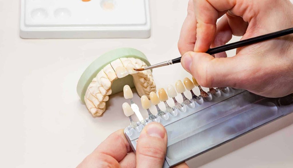 دراسة طب الاسنان في تركيا